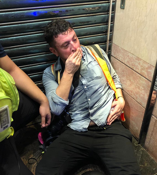 지난달 29일 홍콩 시위를 취재 중이던 영국 출신 프리랜서 기자 토미 워커가 홍콩 경찰이 발포한 고무총탄에 맞고 쓰러져 있다. 사진=토미 워커 트위터 갈무리